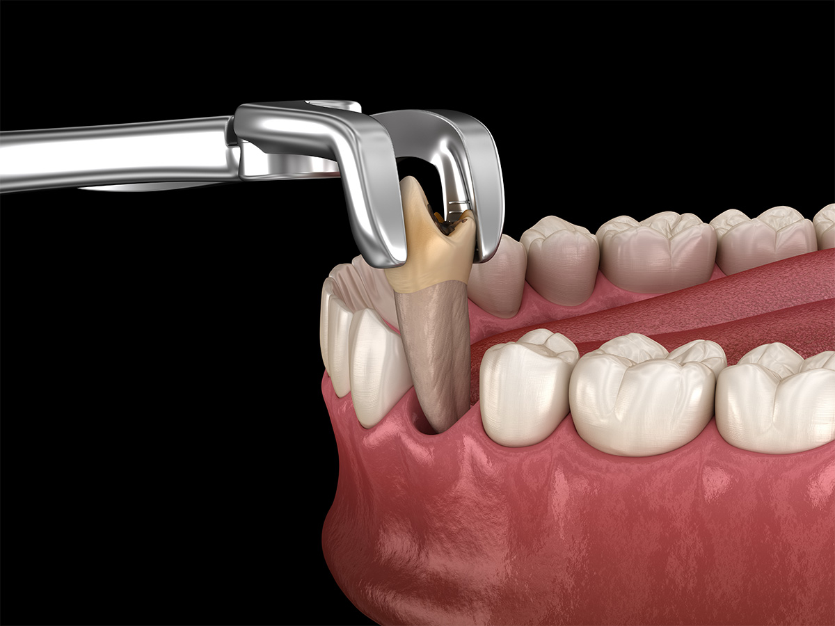 Oral & Maxillofacial Surgery